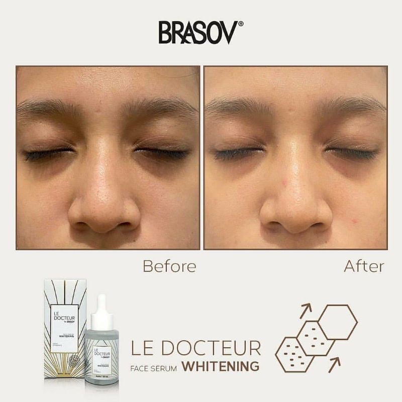 SERUM WAJAH LE DOCTEUR  BY BRASOV