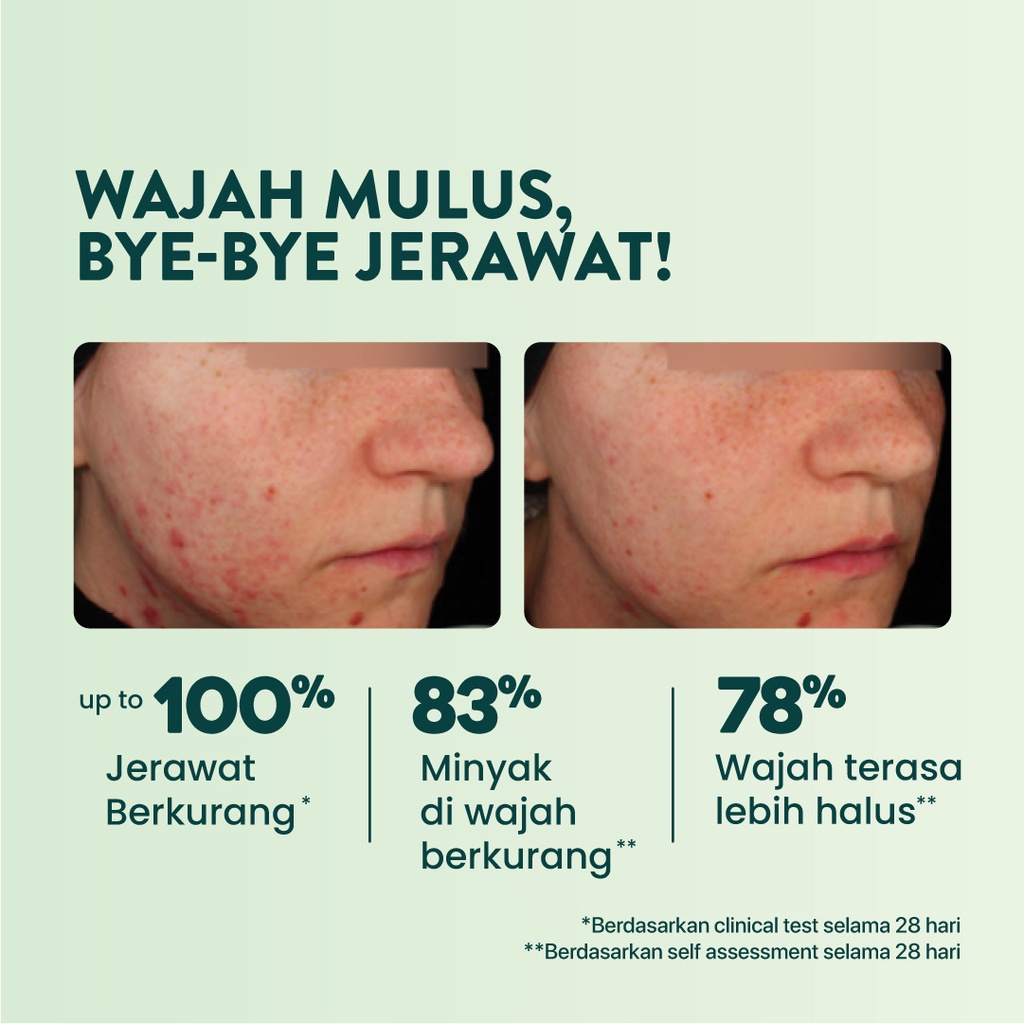 NPURE Cica Face Essence - Serum Essence Penghalus Pelembab Perawatan Acne Wajah Centella Asiatica