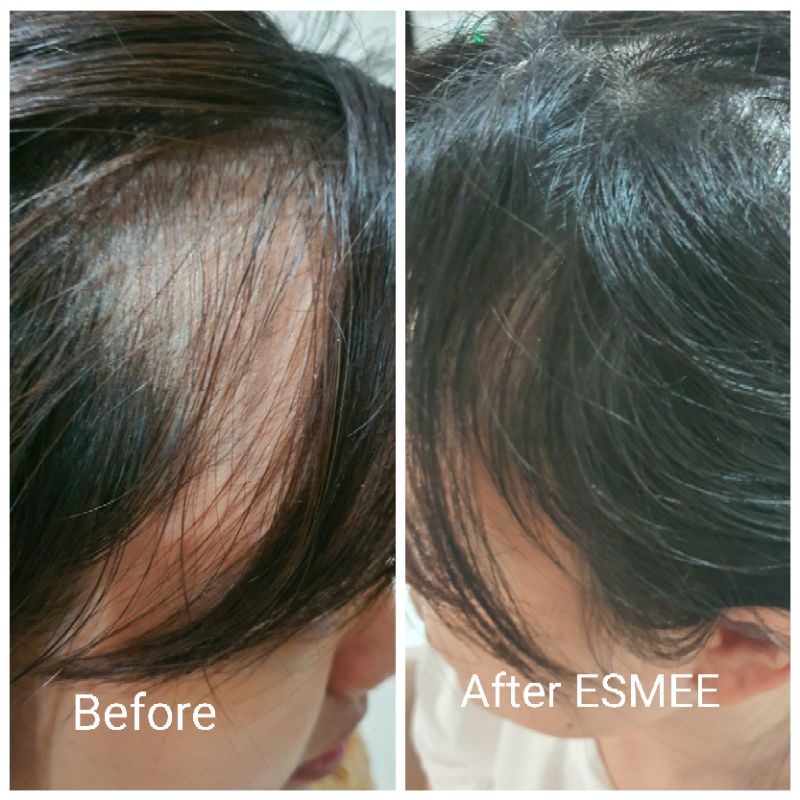 ESMEE HAIRTONIC