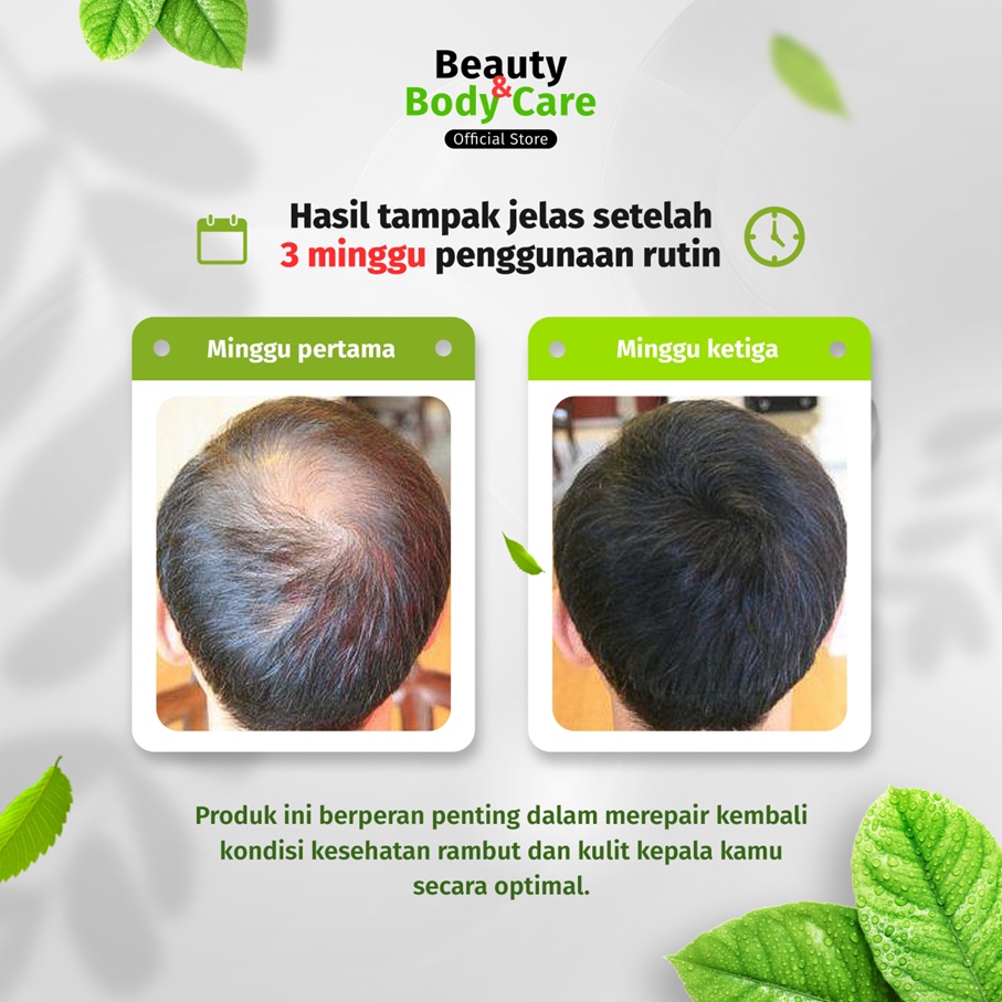 Minyak Kemiri Original 100% Vitamin Penumbuh Perawatan Penyubur Rambut Rontok Botak Parah Cepat Anti Ketombe Untuk Dewasa Pria Wanita Dan Bayi Serum Obat Penebal Penghitam Alis Bulu Mata Jenggot Kumis Rambut Rontok