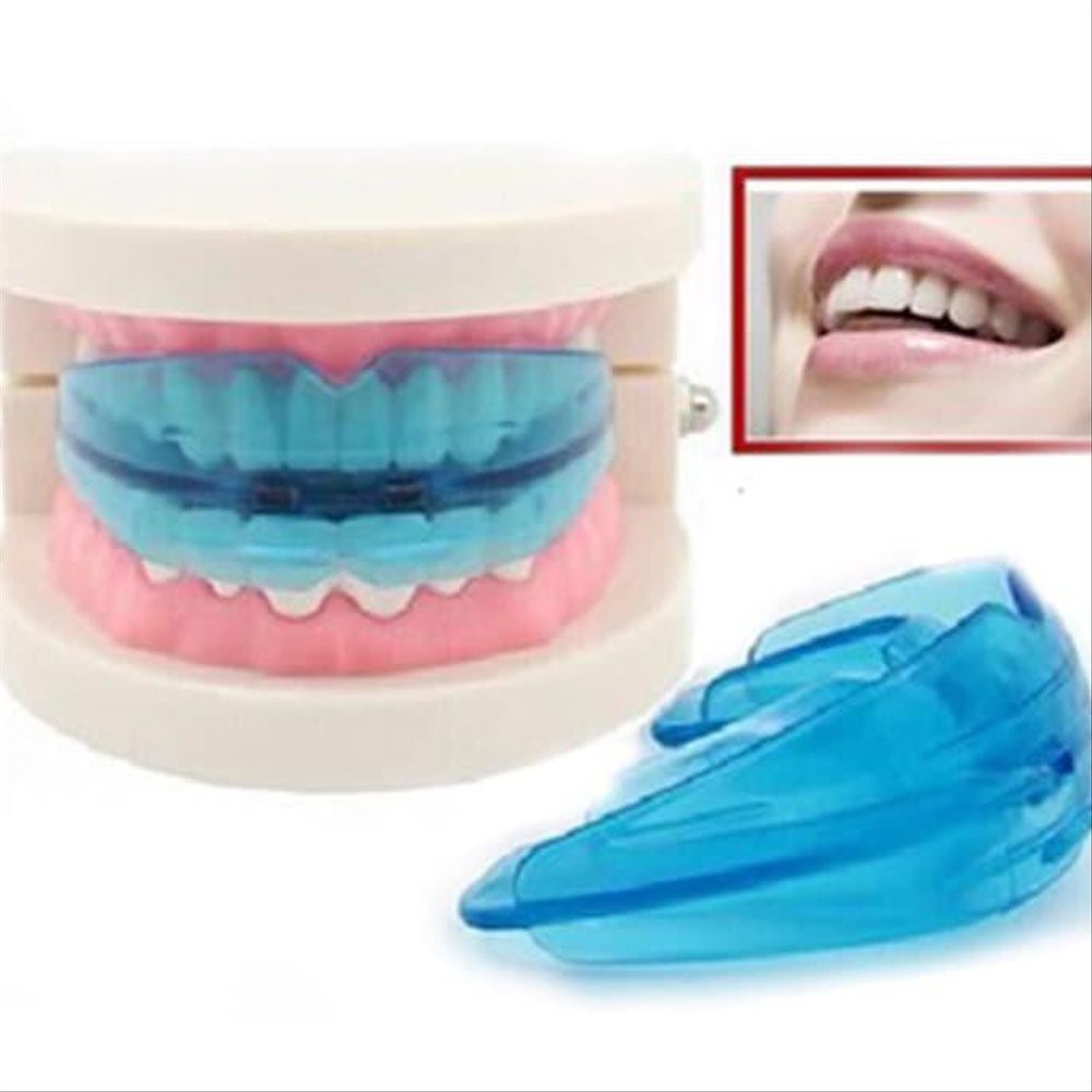 [BIRU] Perapi Gigi Tanpa Behel dari Bahan Silikon Bukan Kawat l Orthodentic Retainer Teeth Phase 1