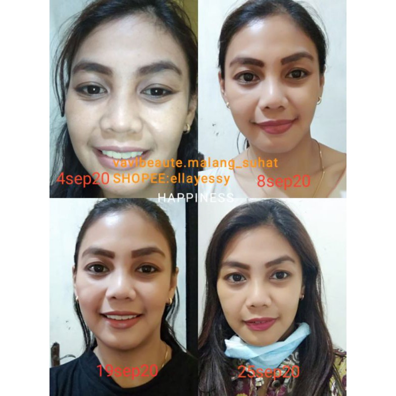 VAVL TERLARIS paket beauty water + blemish serum + free gift