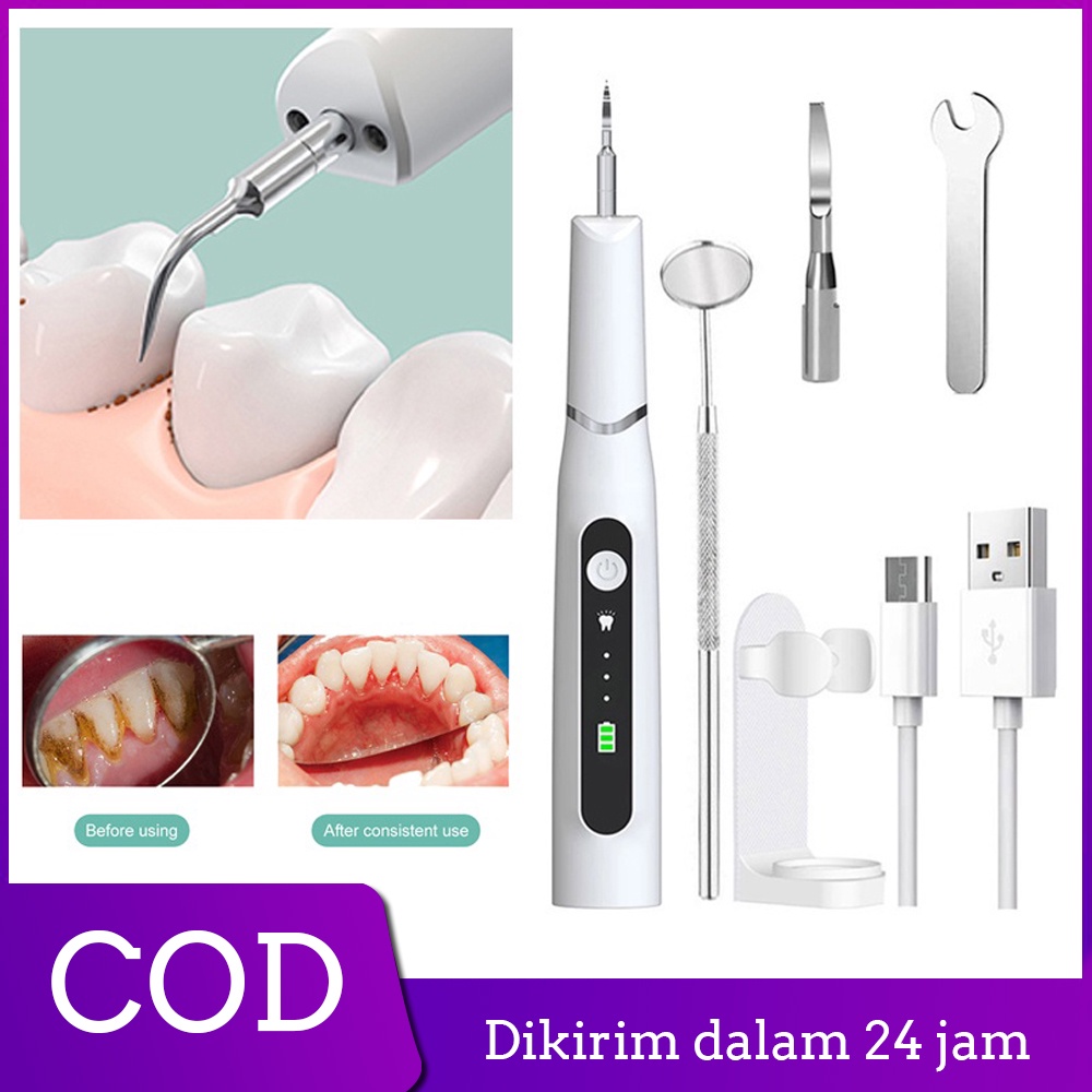 Dental Scaling Alat Pembersih Karang Gigi Sonic Elektrik 1 Set 3 Modes Perawatan