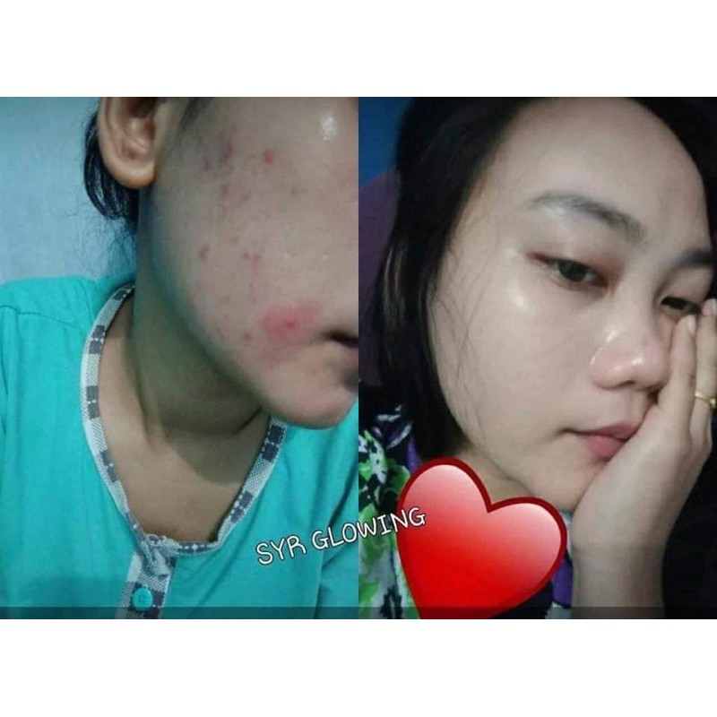 BISA (COD) SYAHRENI GLOWING PAKET LENGKAP / SYR GLOWING PAKET LENGKAP ORIGINAL