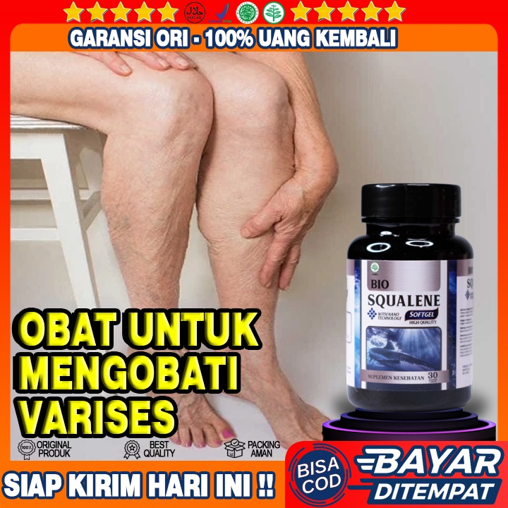Obat Untuk Varises - Obat Varises Bengkak - Obat Varises Bumil - Obat Varises di Kaki - Obat Alami V