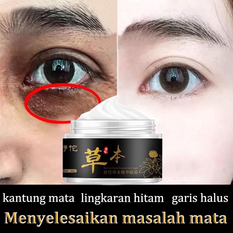 serum mata cream mata panda dan kantung mata Krim mata 40g Ekstrak Sari Herbal Shutuo Untuk Menghilangkan Kerutan Mata Dan Menyehatkan Kulit