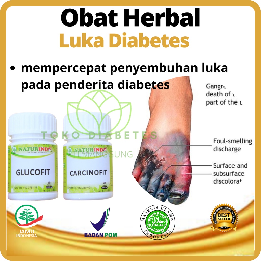 Obat luka diabetes basah koreng diabetes diabet penyembuh luka diabet basah gula tinggi carcinofit g
