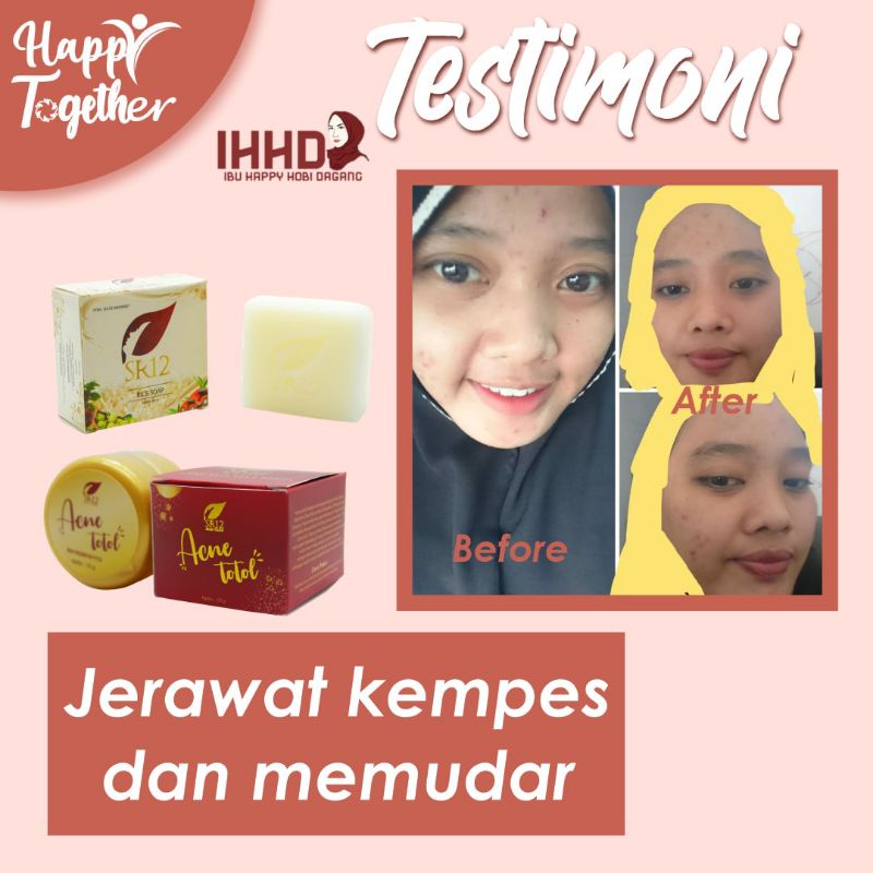 paket jerawat SR12 skincare herbal