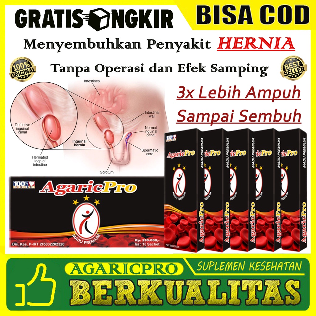 

AGARICPRO - Obat Hernia Turun Berok Anak, Bayi, Balita, Batita hingga Dewasa Paling Ampuh Tanpa Operasi - 1 Box isi 10 Sachet