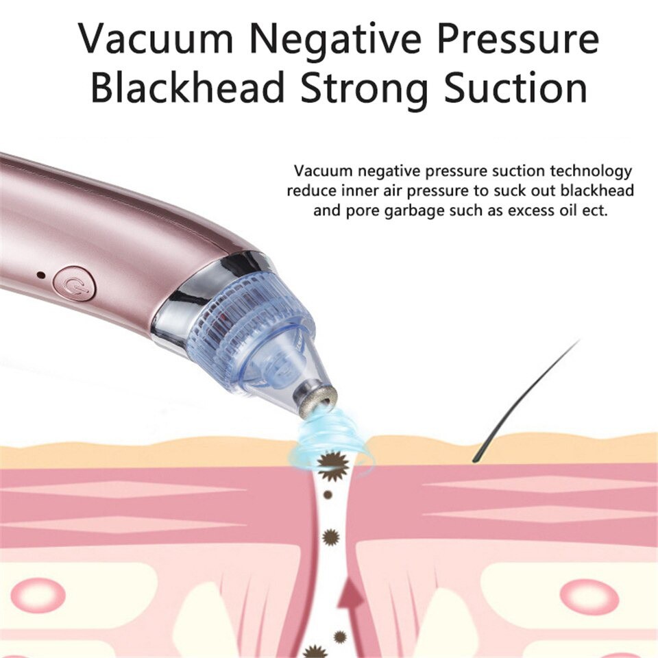 KINDSTORE❤ | CW-666 Alat Mesin Penyedot Komedo - Vacum Pore Cleaner