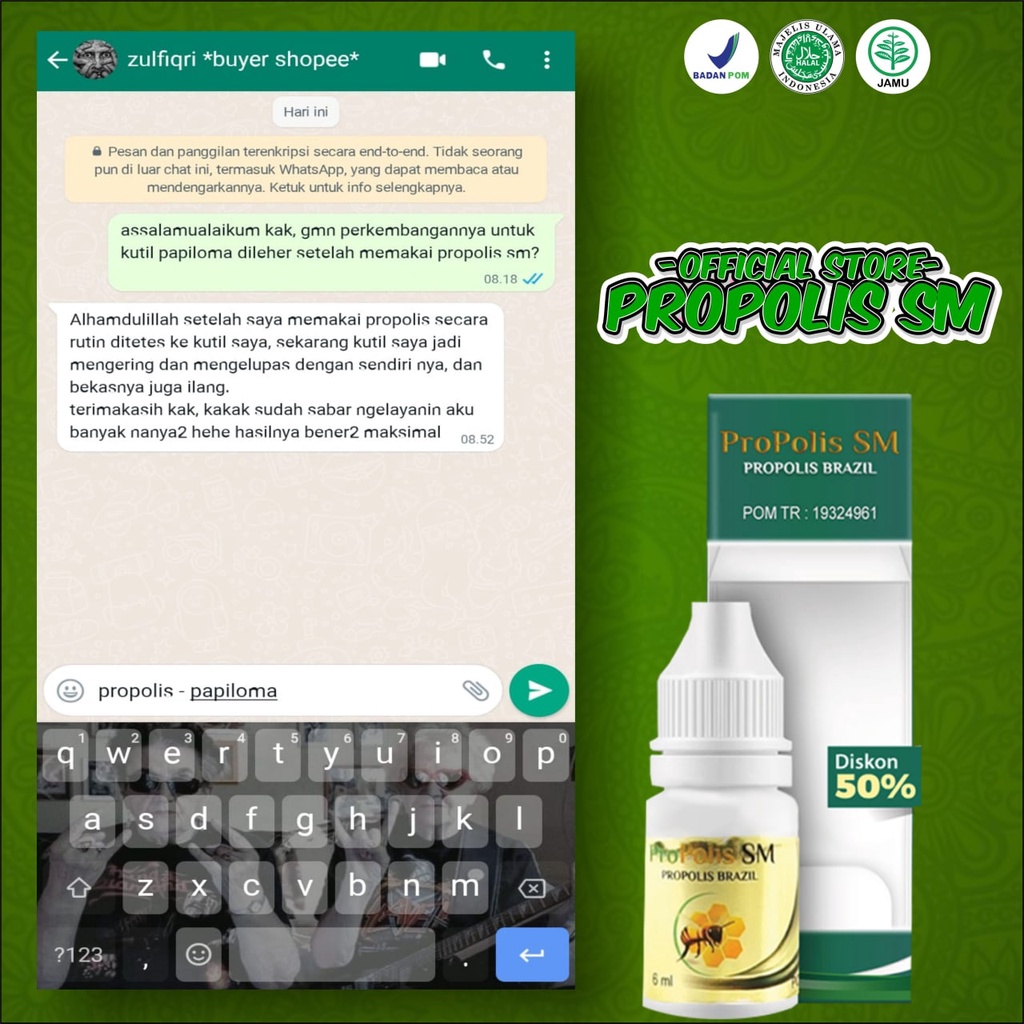 Penghilang Kutil Kelamin Benjol Di Kelamin Sariawan Vagina Bisul Di Kelamin - Pria Wanita Propolis SM-5