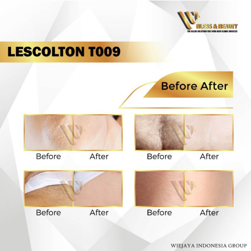 Alat Laser IPL LESCOLTON T009 Hair Removal Bulu Tubuh Permanent Mencerahkan Wajah