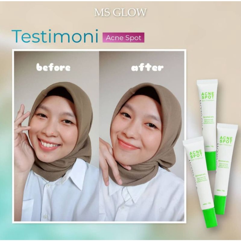 Acne spot ms glow