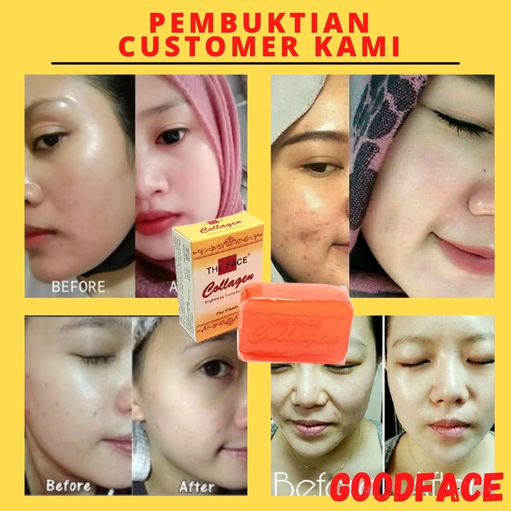 SABUN PENCERAH WAJAH COLLAGEN SOAP ORI BPOM EMBOS