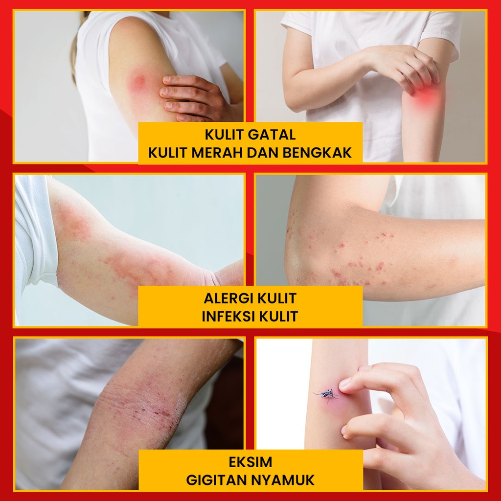 1 Krim/Salep Binahong 20gr Salep gatal kulit paling ampuh