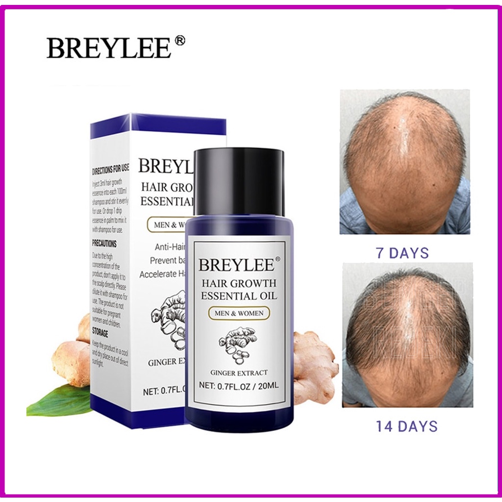 penumbuh rambut botak pelebat dan penebal Penyubur Rontok Untuk Wanita Pria Alami Cepat Q4 PENUMBUH RAMBUT BOTAK PENUMBUH BREWOK PENUMBUH ALIS CEPAT OBAT KUAT PRIA OBAT PENUMBUH RAMBUT BOTAK LICIN SERUM PENCEGAH RAMBUT RONTOK KUSAM AMPUH-3