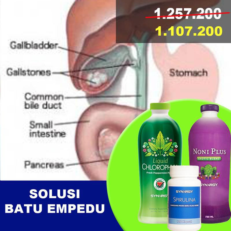 Ramuan Herbal Obat Batu Empedu dari Synergy Worldwide USA Import