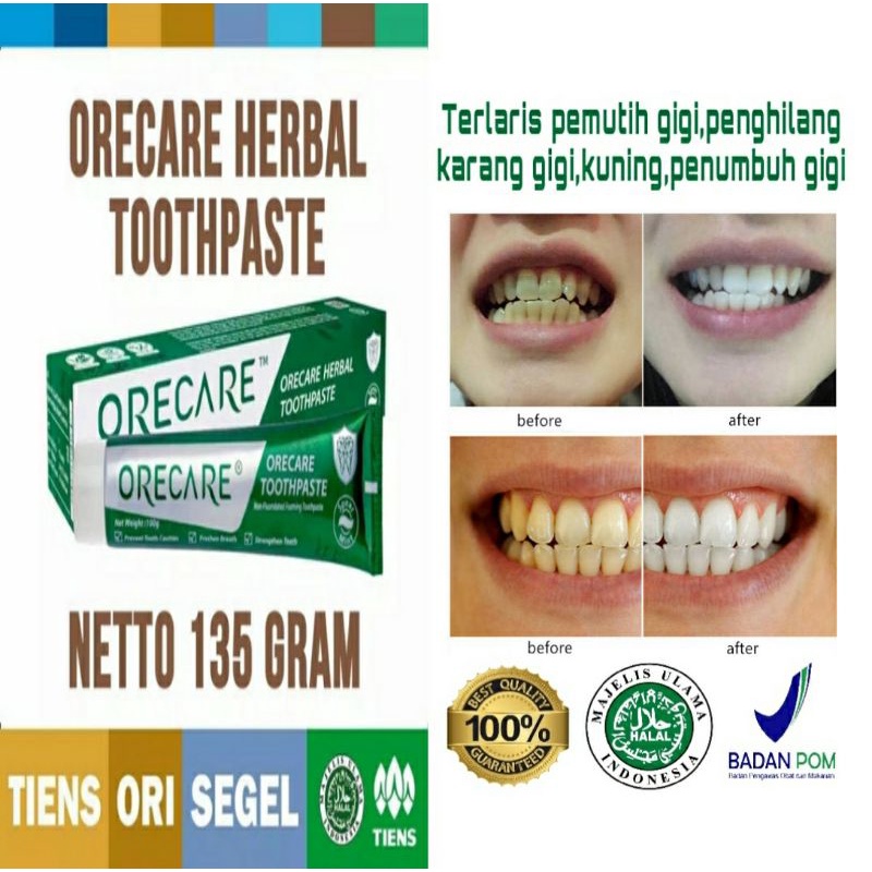 TERBUKTI AMPUH ODOL PEMUTIH GIGI, ODOL PENGHILANG KARANG GIGI