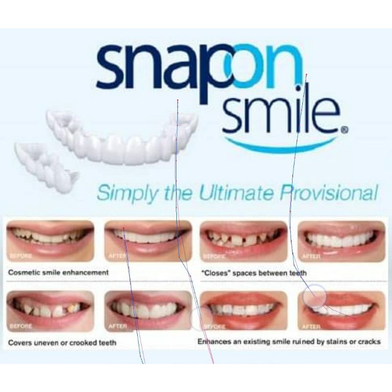 SNAP ON SMILE Gigi palsu ori