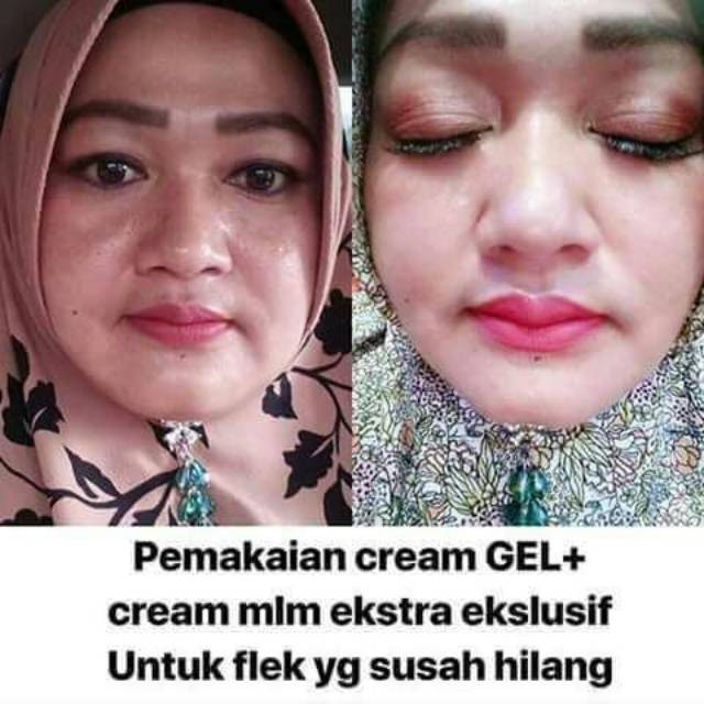 Batrisyia Extra Gel, Cream Malam untuk Masalah Kulit Berat / Flek Membandel