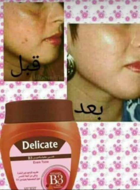 Delicate Krim Pelembab Kulit, menghilangkan strachmark dan flek hitam My Way