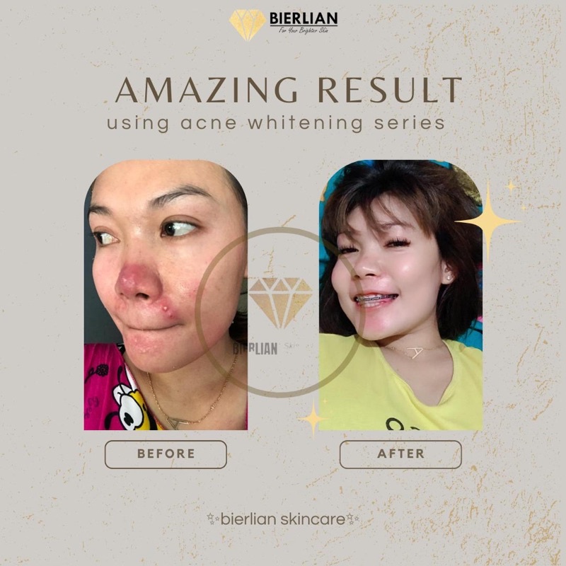 BIERLIAN SKINCARE CREAM WAJAH WHITE GLOW/SUPER WHITE/ACNE/FLEK [Free Pouch+Gift]-8