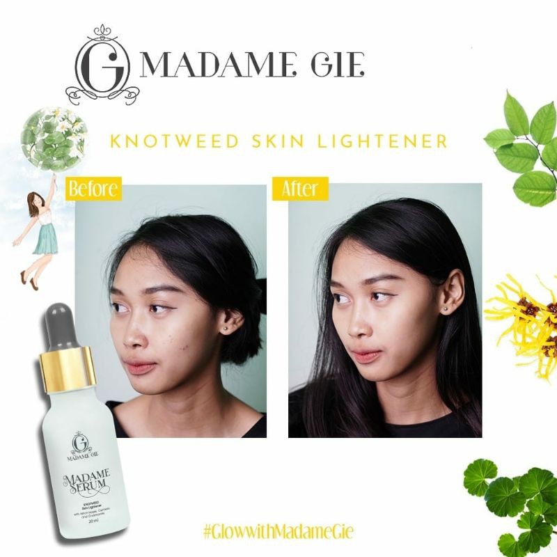 MADAME GIE Madame Serum Skin Care Face Serum Serum Wajah