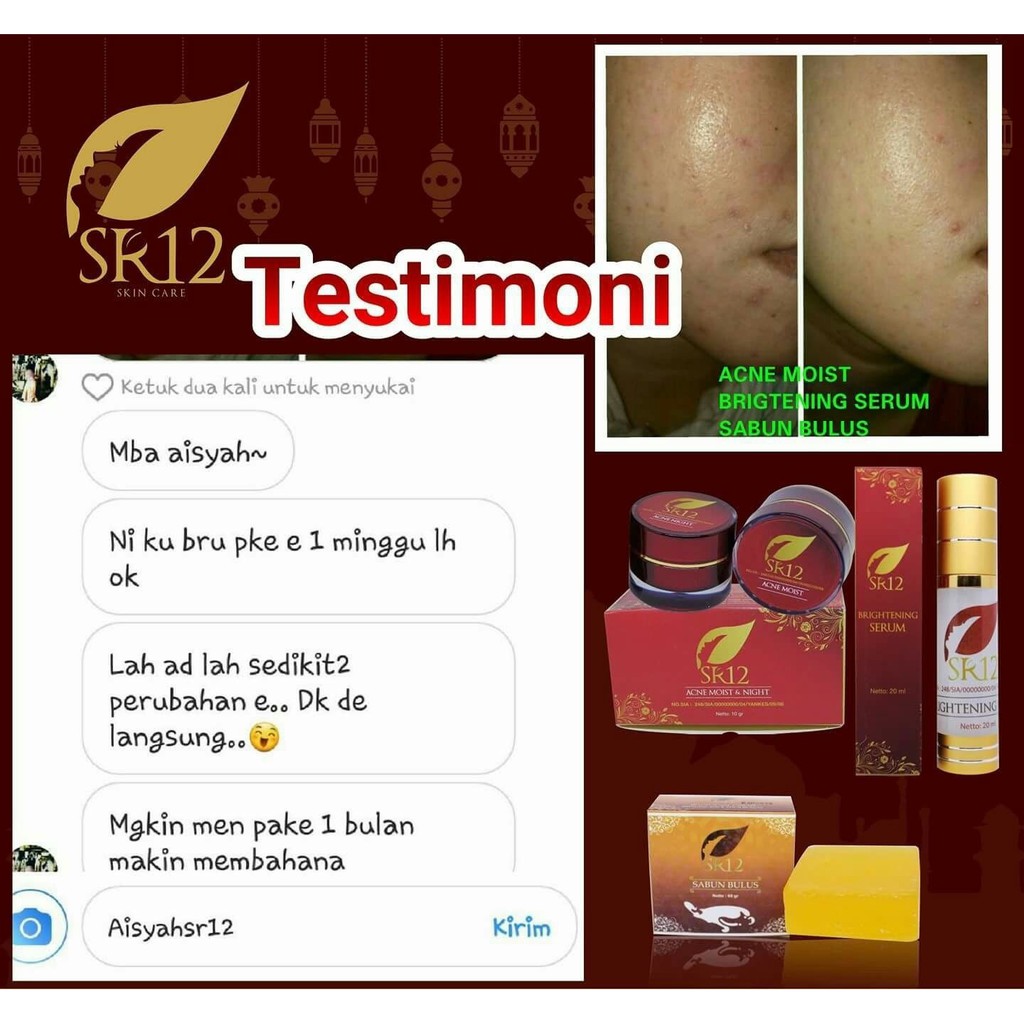 SR12 Acne Moist and Night Cream - Perawatan Jerawat Untuk Muka Wajah - SR12 Skincare - Skin Care
