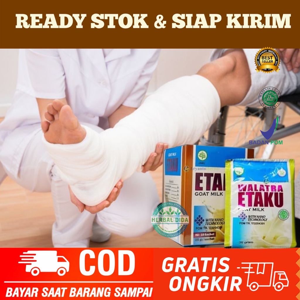 SUSU KAMBING ETAKU 100% BPOM, Susu atasi Patah Tulang & Retak, Susu Untuk Patah Tulang/Tulang Retak,