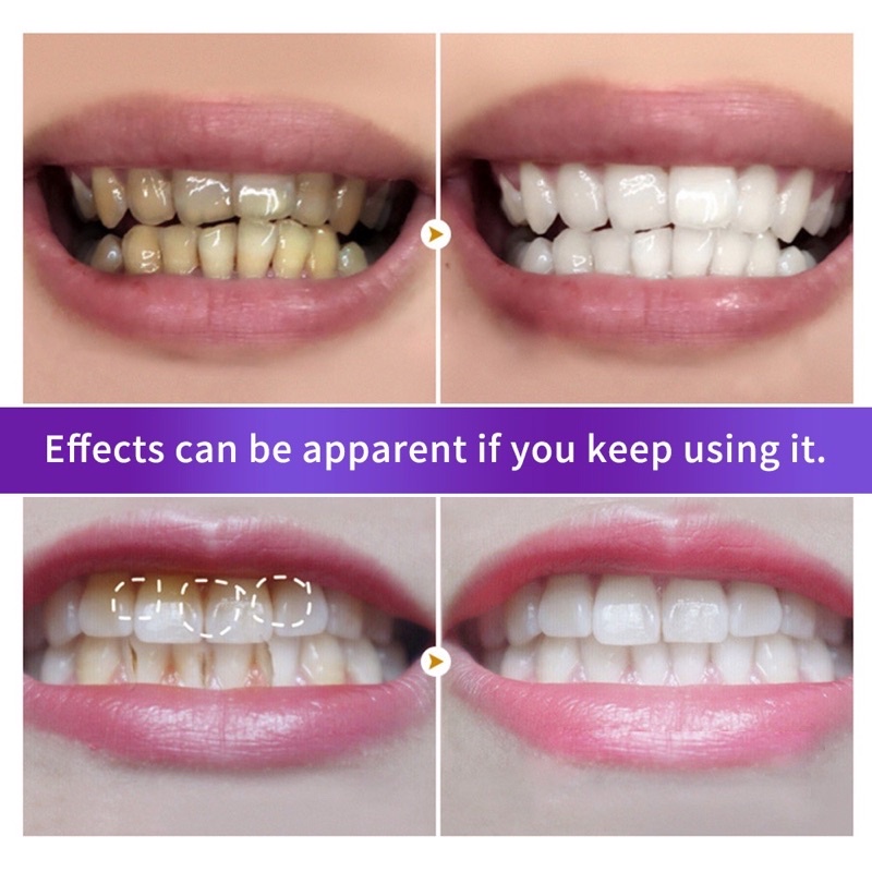 [BPOM] BREYLEE Teeth Whitening Powder odol Pemutih Gigi Dan Karang Gigi Pen Pembersih Karang Gigi Memutihkan Gigi Perawatan Diri Removes Plaque Stains Oral Hygiene Bleaching Dental Tool