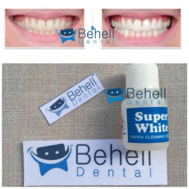 Pemutih Gigi Ampuh Super White / superwhite / obat ALAT penghilang PERONTOK AMPUH karang gigi