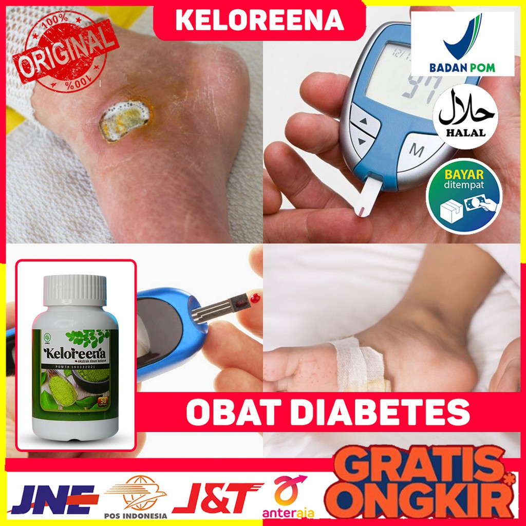 Obat Luka Diabetes Basah, Obat Pengering Luka Diabetes Basah, Obat Luka Diabetes Agar Cepat Kering, 