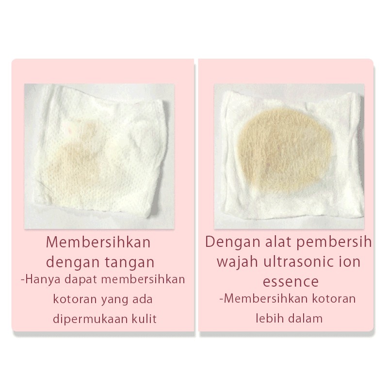 alat setrika wajah glowing ion 4in1 /setrika wajah penghilang kerutan/alat pijat wajah/alat pengencang wajah