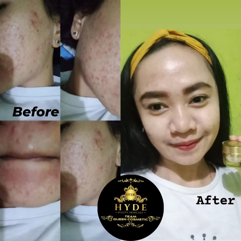 Hyde Beauty Skincare Paket Glowing