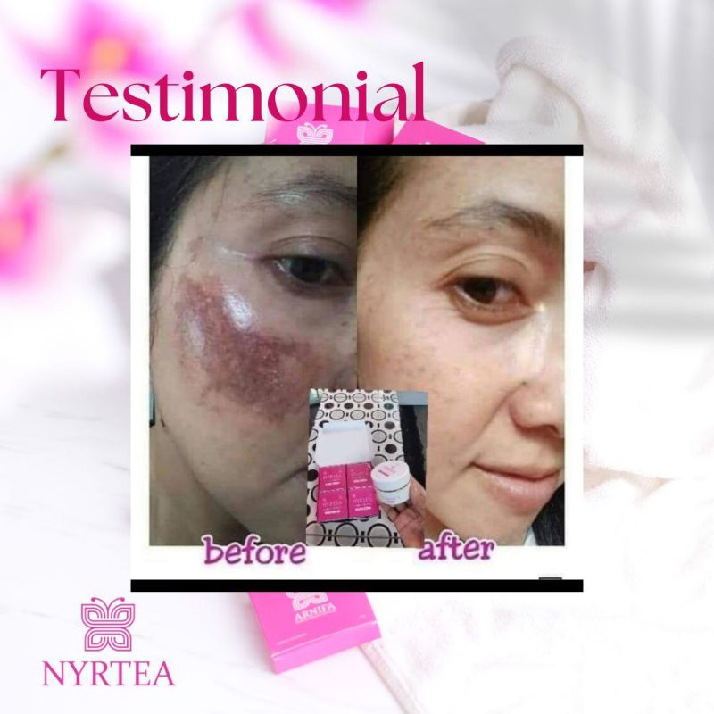 Nyrtea Sunscreen SPF 30 100% ORIGINAL Member Resmi
