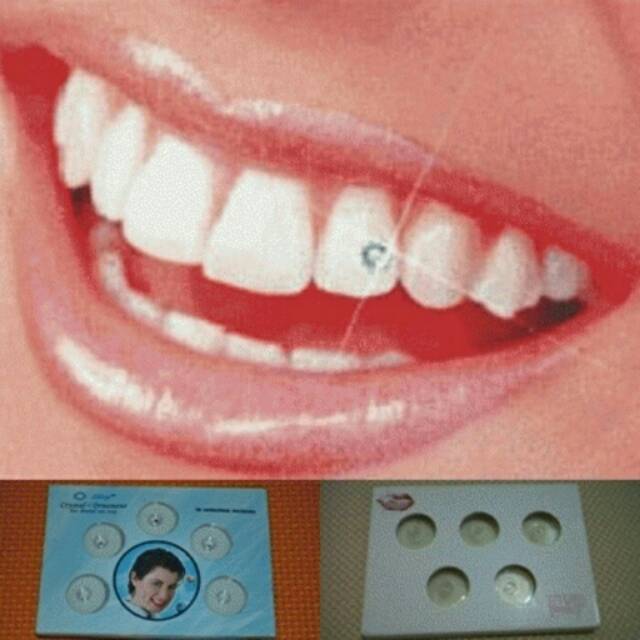 Berlian Gigi Diamond Gigi Permata Gigi