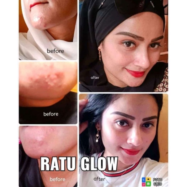  RATU GLOW PAKET PLATINUM (lebih cocok untuk yg sudah punya flek hitam)-5