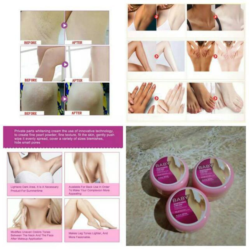 CREAM PEMUTIH KETIAK, PANTAT DAN SELANGKANGAN