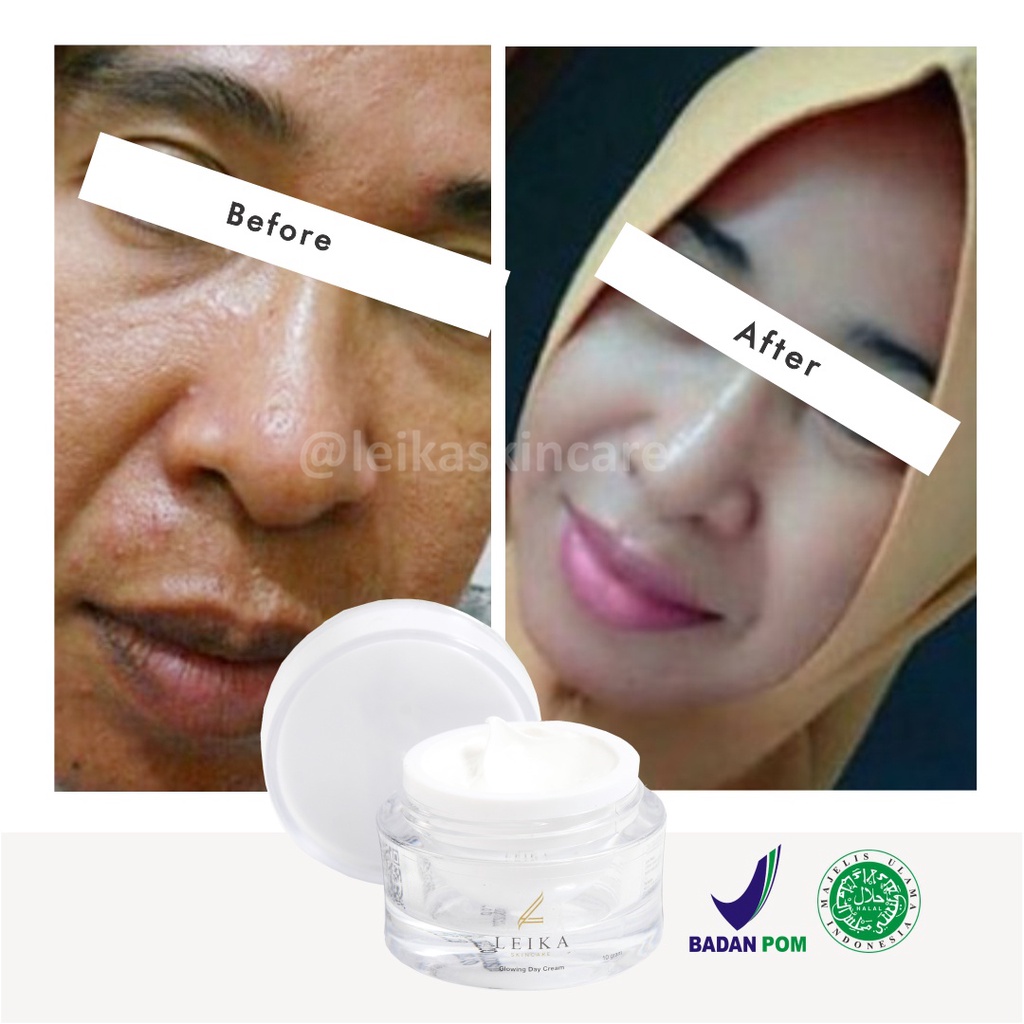 Krim Anti Penuaan Dini Menakjubkan Cepat Asli 100% BPOM Cream Anti Aging Terbaik Ampuh Pria Wanita Halal MUI Glowing Day Cream Leika Skincare 10gr Cream Anti Garis Keriput di Wajah Resmi BPOM