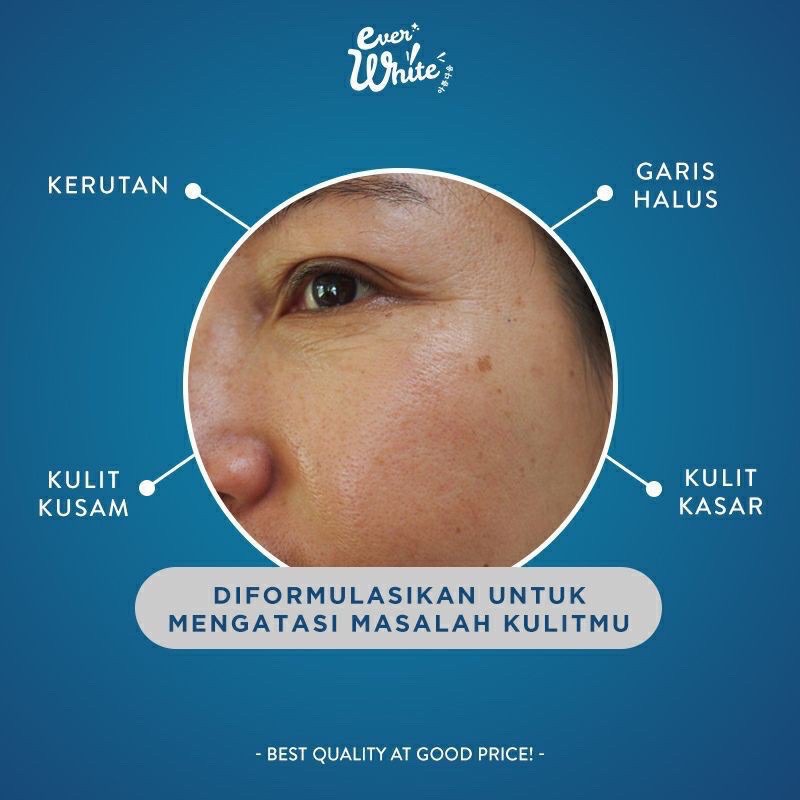 EVERWHITE Peptide Anti Aging Serum Indonesia / Toner Peptide Eye Cream Gel / Acnepair Underarm Cica