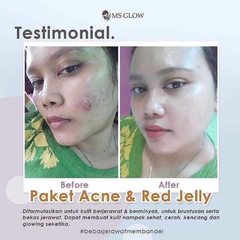 MS GLOW Acne Clear Toner Indonesia / Glowing Facial Wash Serum Night Cream Clay Mask Eye Gel Masker