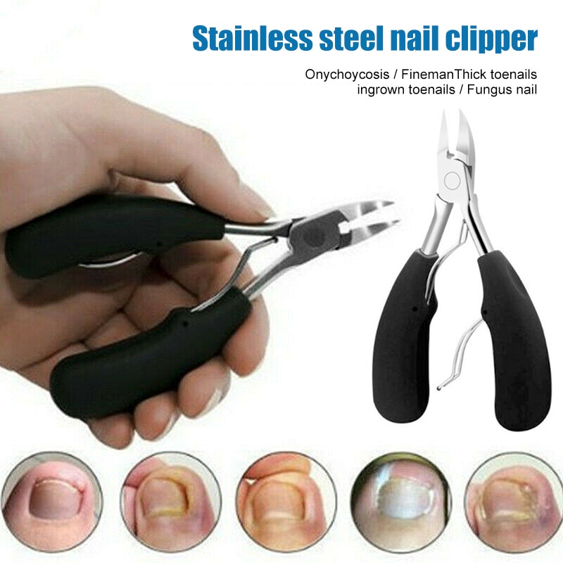 Biutte.co Gunting Kuku Jempol Kaki Anti Cantengan Bongkar kuku menusuk ke daging super tajam efektif Nail Clipper jempol bengkak bernanah infeksi canteng New Toe Nail Clippers 1PC Nail Correction Nippers Clipper Cutters Dead Skin Dirt Remover Podiatry