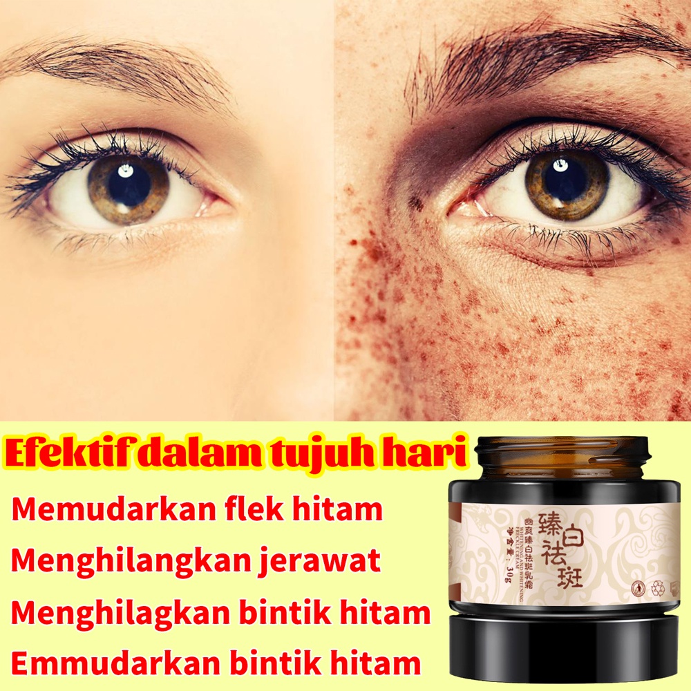 【COD】krim pemutih dan menghilangkan flek / krim pemutih wajah / memudarkan flek hitam menghilangkan jerawat / cepat menghilangkan bintik hitam menghilangkan flek hitam / menghilagkan bintik hitam / emmudarkan bintik hitam