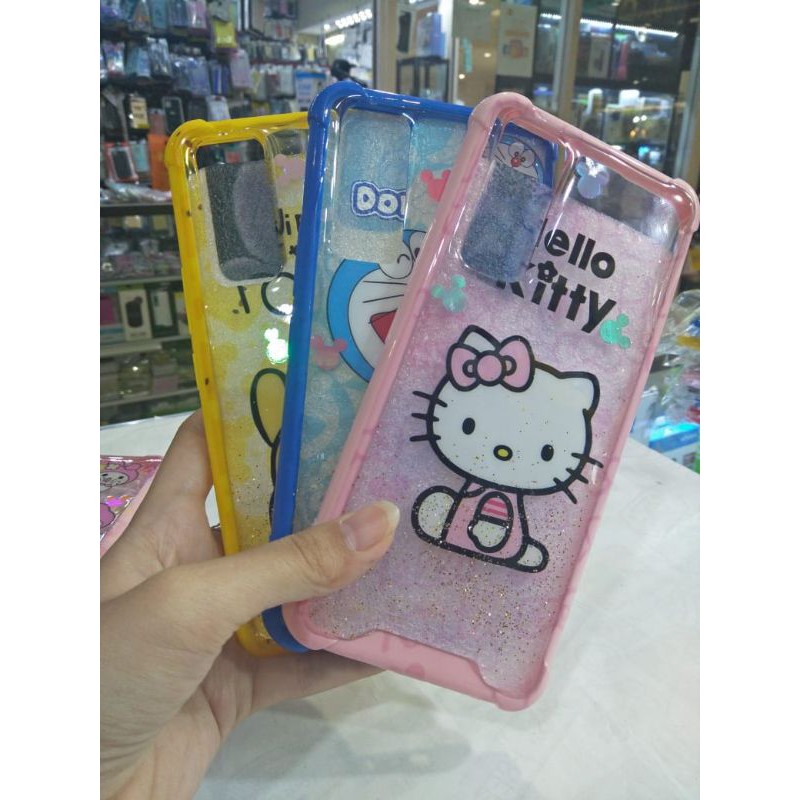 CASE GLITTER KARTUN KOMBINASI VIVO V20 SE