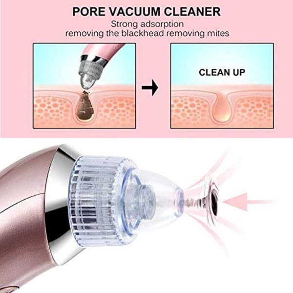 Alat Penyedot Vakum Komedo XN-8030 Blackhead Cleaner