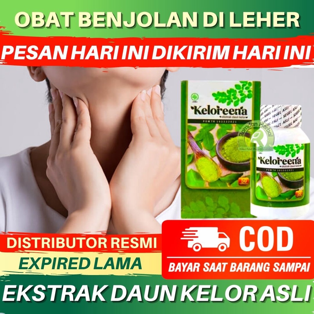Jual Obat Untuk Benjolan Di Leher, Gondongan, Gondok, Kelenjar Getah