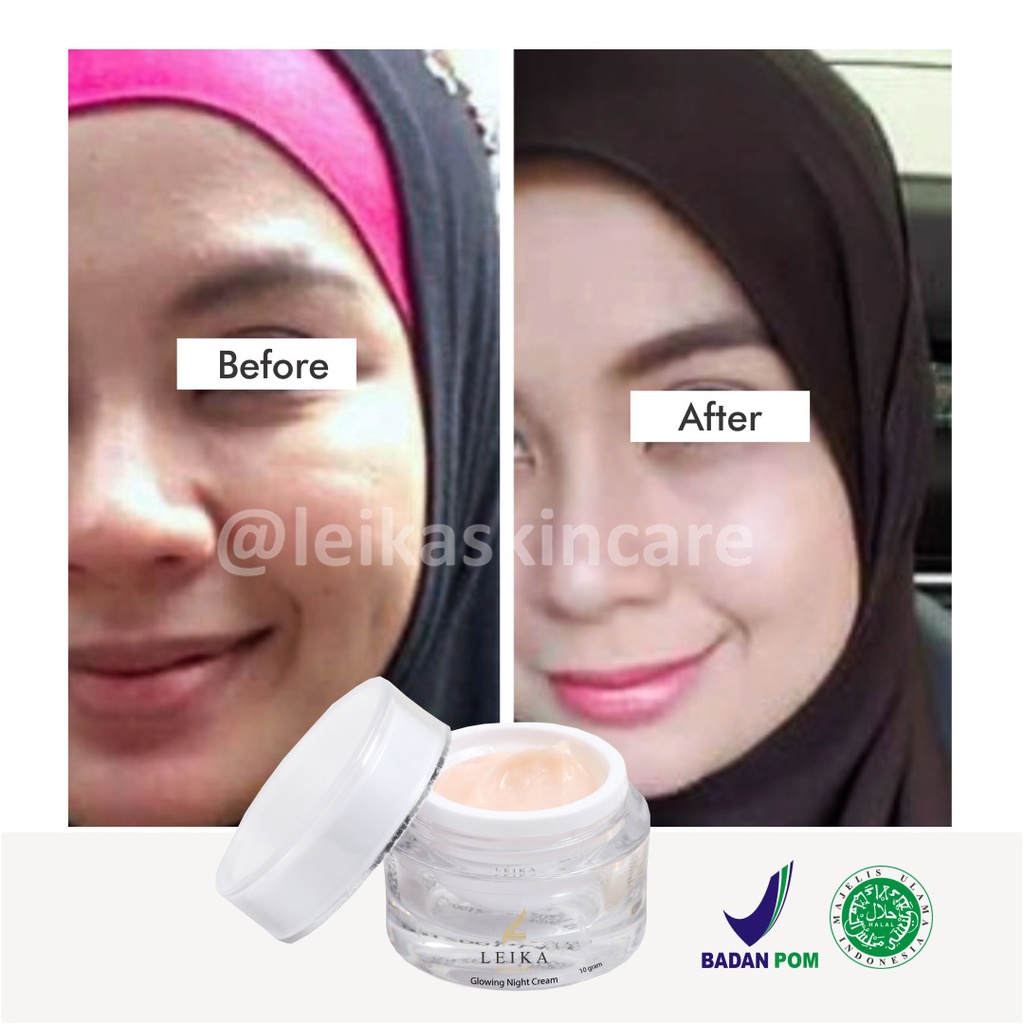 Krim Anti Penuaan Wajah Ampuh! Krim Anti Aging Wajah Korea Terbaik Resmi BPOM Krim Anti Penuaan Dini Asli Halal MUI Glowing Night Cream Anti Aging Leika Skincare 10gr