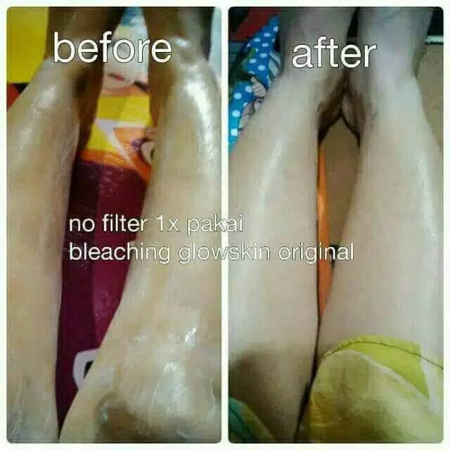 Bleaching badan super / body bleaching