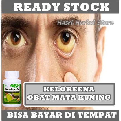 Obat Penyakit Kuning Mata Kuning Kulit Kuning, Obat Hepatitis, Hepatitis A B Dan C, Obat Liver, Liver Membengkak, Obat Liver Paling, Obat Pembengkakan Hati, Obat Limpa Herbal Dengan Keloreena Ekstra Daun Kelor