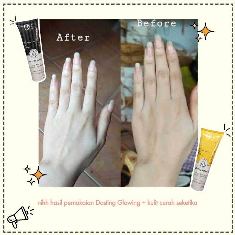 ❤ RATU ❤ Dosting Glow + Hand Body Lotion Whitening Tone Up | Lotion Siang | Lotion Malam | Sabun | Body Scrub | Stretchmark Cream